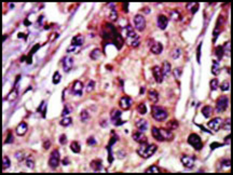 Anti-PACSIN3 (center) antibody produced in