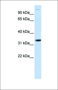 Anti-ANP32B antibody produced in rabbit