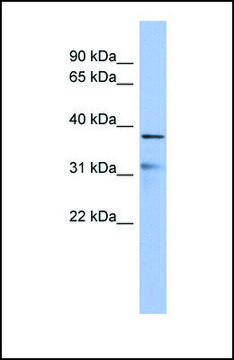 Anti-HEY2 antibody produced in rabbit