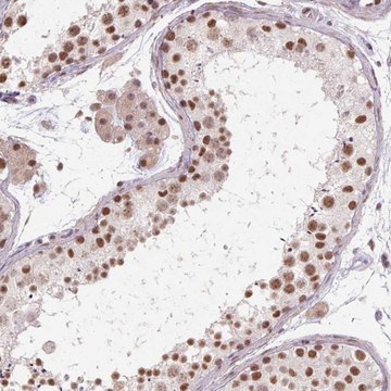 Anti-CYHR1 antibody produced in rabbit