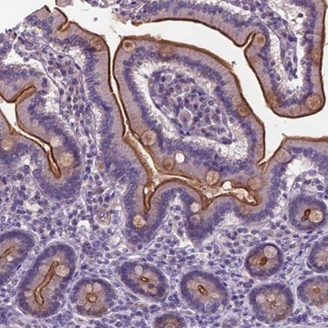 Anti-TM4SF20 antibody produced in rabbit