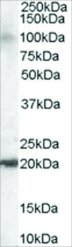 Anti-GTRAP3-18/JWA antibody produced in goat