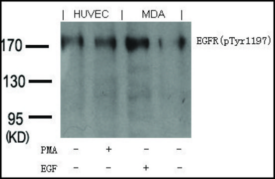 Anti-phospho-EGFR (pTyr¹¹??) antibody produced in