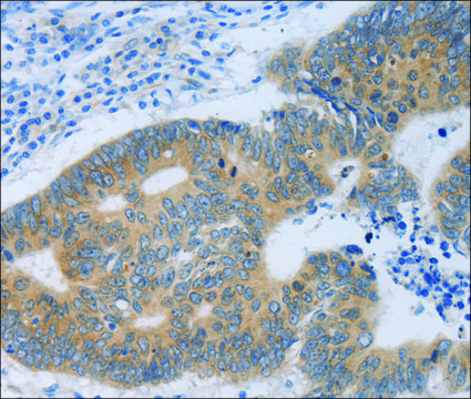 Anti-MT2A antibody produced in rabbit