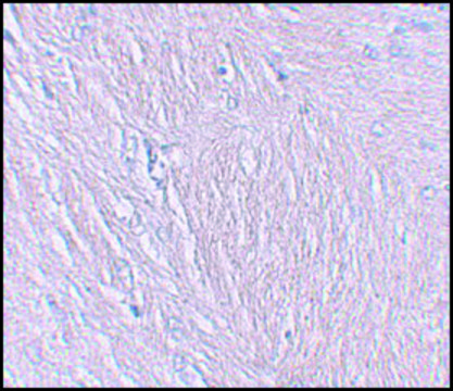 Anti-SYNPO antibody produced in rabbit