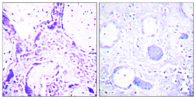 Anti-PPAR-? antibody produced in rabbit