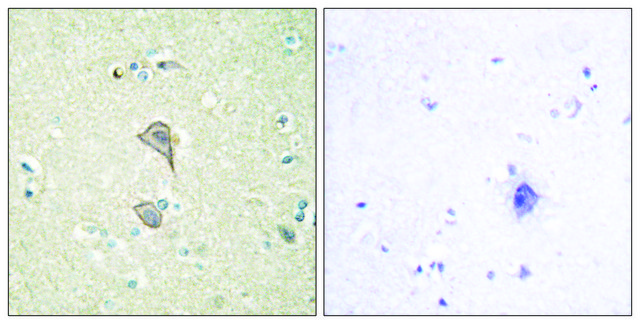 Anti-NKTR antibody produced in rabbit