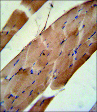 ANTI-CNO6L (C-TERM) antibody produced in