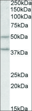 Anti-Mboat4 antibody produced in goat