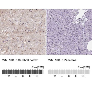 Anti-WNT10B antibody produced in rabbit