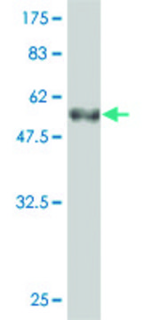 Monoclonal Anti-CRYBB1 antibody produced in