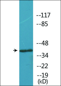 Anti-phospho-Opioid Receptor-? (pSer³?³) antibody produced