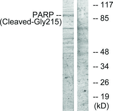 Anti-PARP (Cleaved-Gly²¹?) antibody produced in