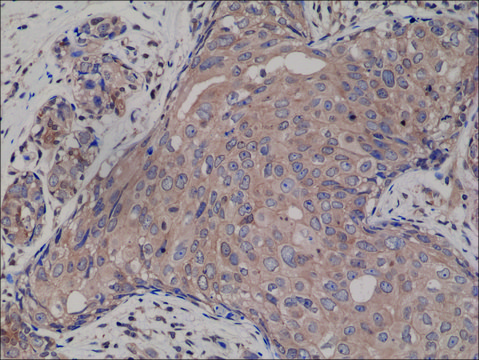 Anti-SMAD4 antibody, Rabbit monoclonal