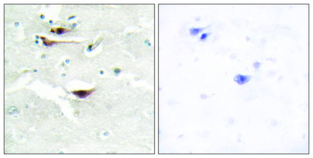 Anti-IPPK, N-Terminal antibody produced in