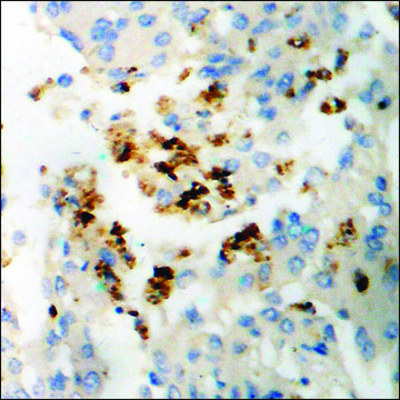 Anti-phospho-SGK (pSer?²²) antibody produced in