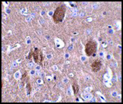 Anti-CDIP antibody produced in rabbit