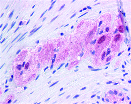 Anti-FOXC1, (N-terminal) antibody produced in