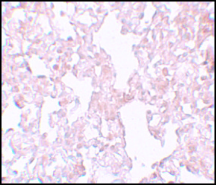 Anti-MFSD1 antibody produced in rabbit