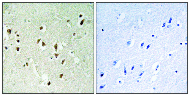 Anti-GRF-1 antibody produced in rabbit