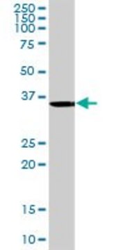 Anti-ANKRA2 antibody produced in rabbit