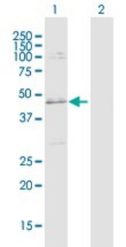 Anti-SLC25A31 antibody produced in rabbit