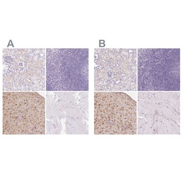 Anti-IGFBP1 antibody produced in rabbit