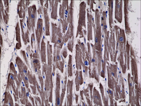 Anti-Acetyl-CoA Carboxylase antibody, Rabbit monoclonal