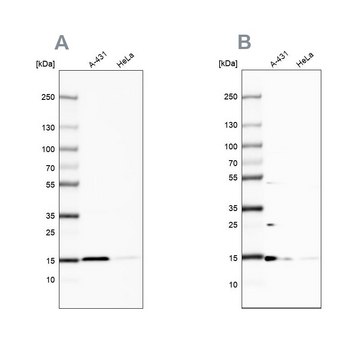Anti-CCDC58 antibody produced in rabbit