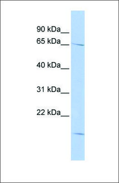 Anti-RANBP3 antibody produced in rabbit