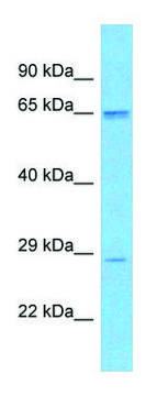 Anti-SCD5 antibody produced in rabbit