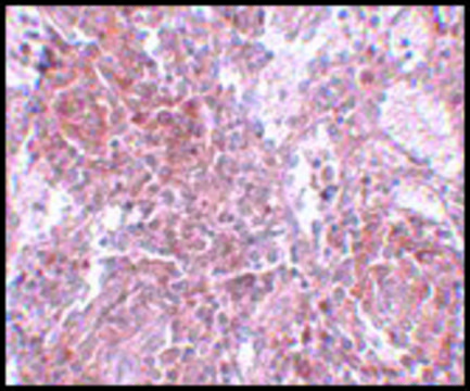 Anti-TSPAN9 antibody produced in rabbit