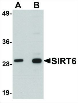 Anti-SIRT6 antibody produced in chicken