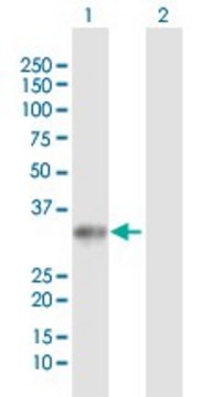 Anti-UCK2 antibody produced in rabbit