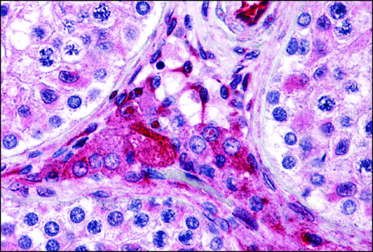 Anti-PTCHD2 antibody produced in rabbit