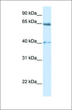 Anti-CACNB2 (ab1) antibody produced in
