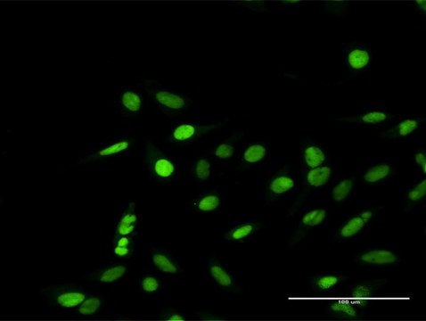 Anti-RPA1 antibody produced in rabbit