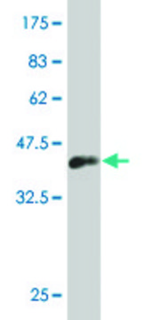 ANTI-LHX1 antibody produced in mouse