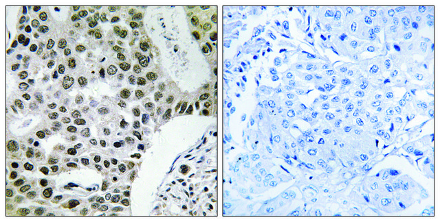 Anti-ZMYM4 antibody produced in rabbit