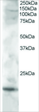 Anti-Cystatin F/CMAP antibody produced in