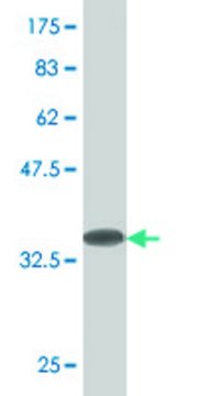 Monoclonal Anti-RACGAP1, (N-terminal) antibody produced