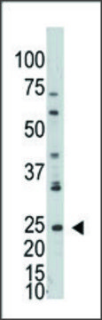 Anti-ADPRH (C-term) antibody produced in
