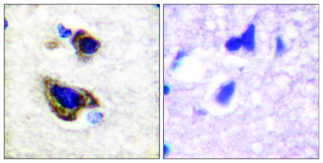 Anti-GFAP antibody produced in rabbit