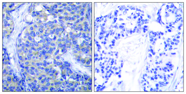 Anti-ZAP-70 antibody produced in rabbit
