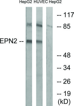 Anti-EPN2 antibody produced in rabbit