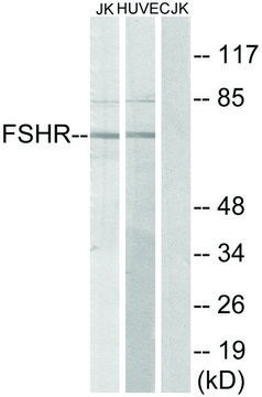 Anti-FSHR antibody produced in rabbit
