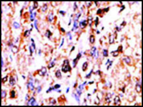 Anti-GUCY1B2 (N-term) antibody produced in