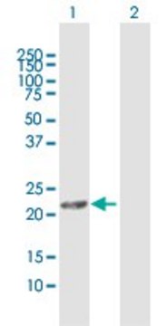 Anti-DHRS11 antibody produced in rabbit