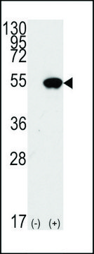 ANTI-P53 (S15) antibody produced in
