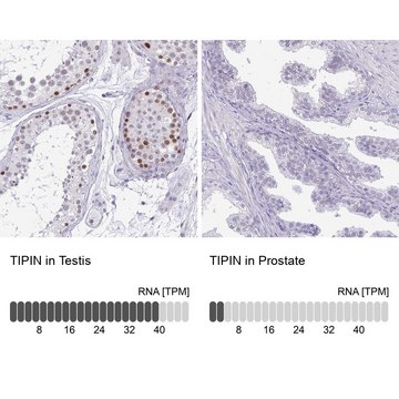 Anti-TIPIN antibody produced in rabbit